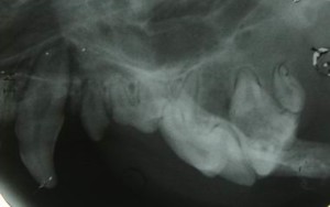 HIPO4