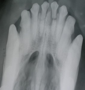 חני רצקין - צילום רנטגן של שיניים שבורות
